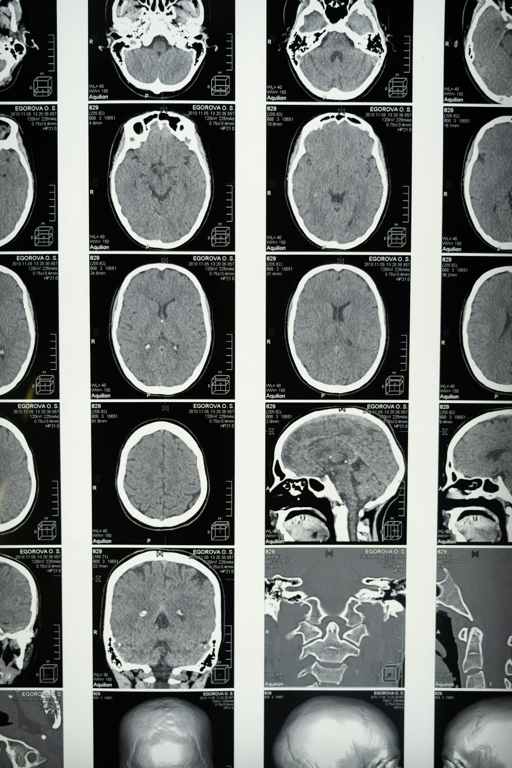 Comprehensive set of brain MRI scans highlighting cranial anatomy for medical use.